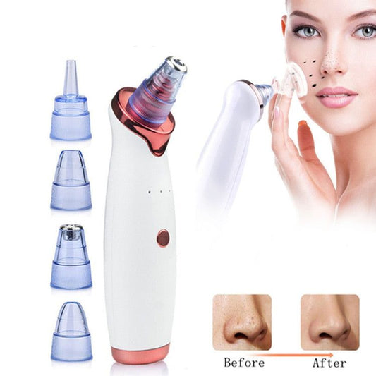 Electric Vacuum Pore Cleanser - MTR210